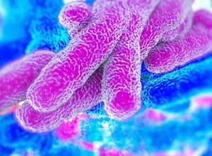 Legionella